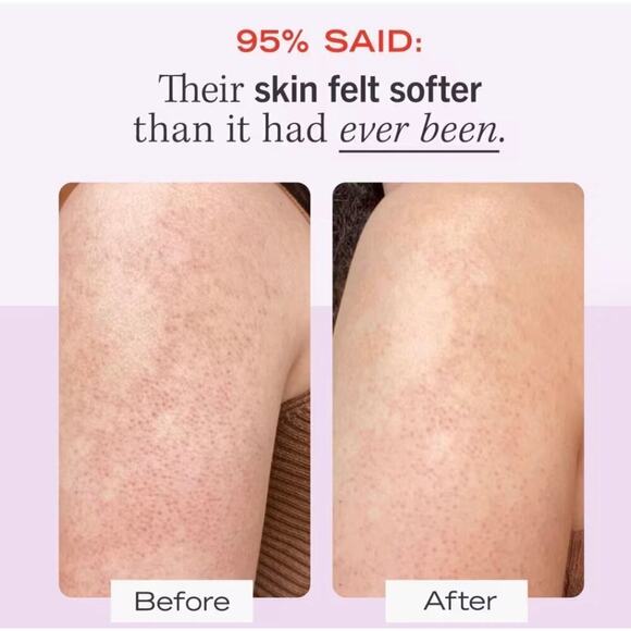 First Aid Beauty KP Bump Eraser Body Scrub - Picture 6 of 7